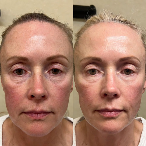 Calm Skin. Strong Barrier. Zero Heaviness.