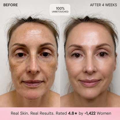 The 5-Oil Serum That Softens the Look of Fine Lines — Without Retinol Irritation