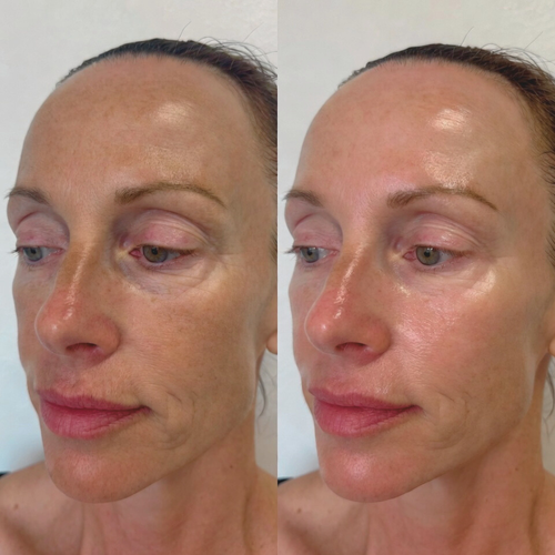Calm Skin. Strong Barrier. Zero Heaviness.
